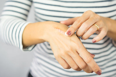 Wound Advisor