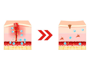 Diagram of wound before and after healing